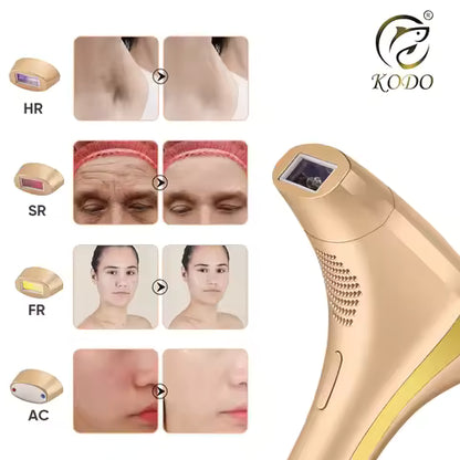 Luvario laser épilation